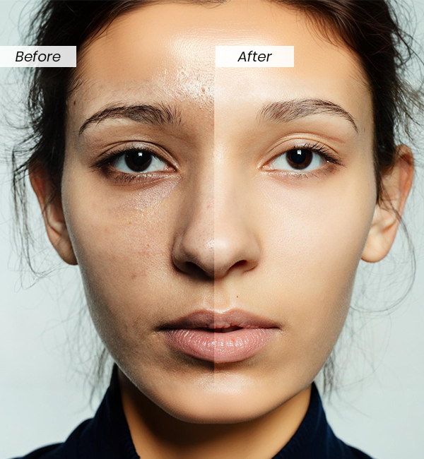 kojic-acid-face-serum-before-after | QuickLook
