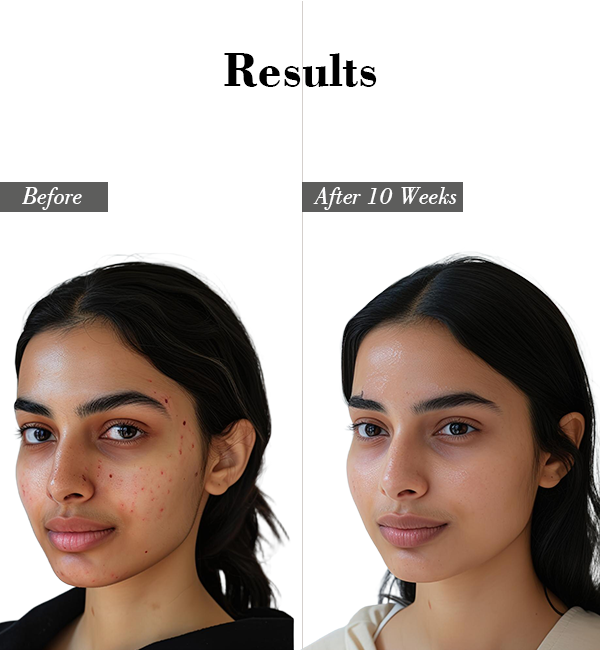 neem-aloevera-face-wash-before-after | QuickLook